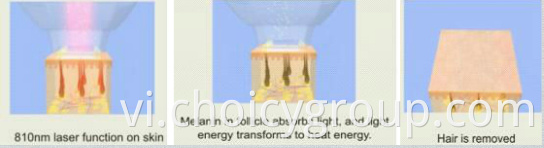 Diode laser Working theory